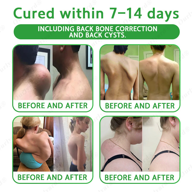 🦴FDA Approved|Ourlyard® Advanced Magnesium & Emu Oil Massage Pain Relief Cream (🏅The Ultimate Solution for Muscle Aches, Arthritis, Joint Pain, Nerve Pain, Inflammation, and Stiffness)