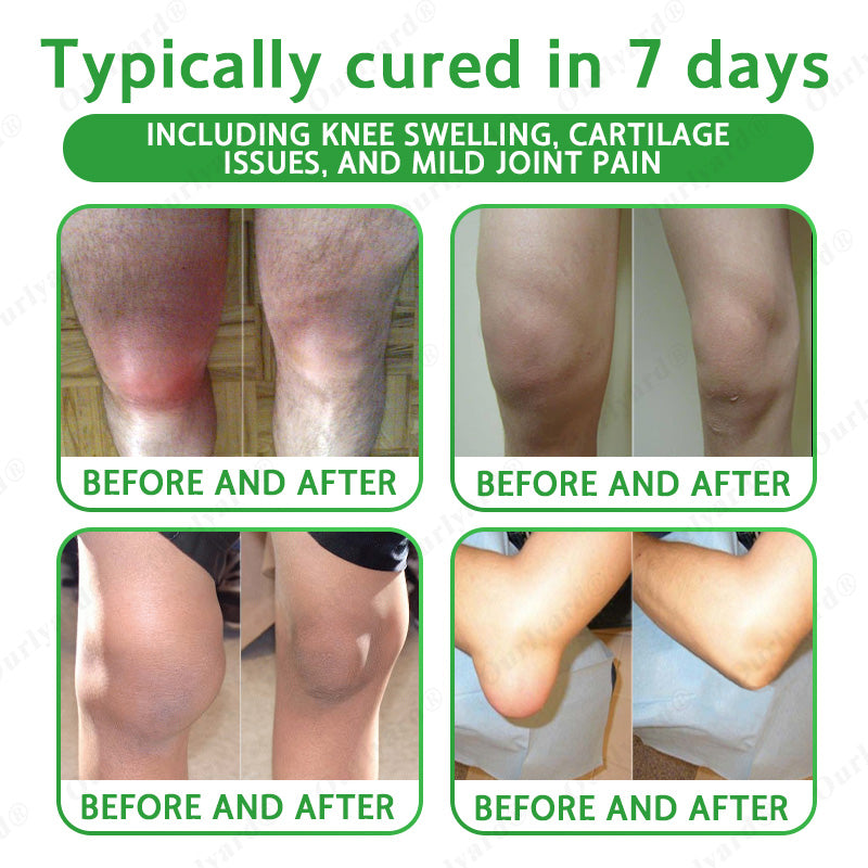 🦴FDA Approved|Ourlyard® Advanced Magnesium & Emu Oil Massage Pain Relief Cream (🏅The Ultimate Solution for Muscle Aches, Arthritis, Joint Pain, Nerve Pain, Inflammation, and Stiffness)