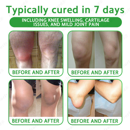 🦴FDA Approved|Ourlyard® Advanced Magnesium & Emu Oil Massage Pain Relief Cream (🏅The Ultimate Solution for Muscle Aches, Arthritis, Joint Pain, Nerve Pain, Inflammation, and Stiffness)