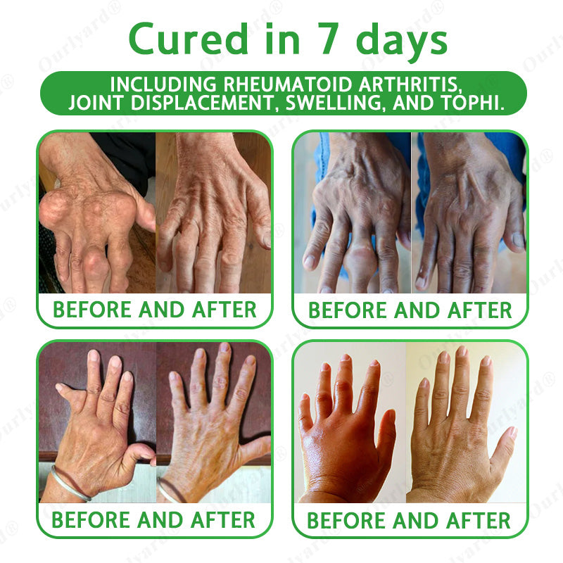 🦴FDA Approved|Ourlyard® Advanced Magnesium & Emu Oil Massage Pain Relief Cream (🏅The Ultimate Solution for Muscle Aches, Arthritis, Joint Pain, Nerve Pain, Inflammation, and Stiffness)